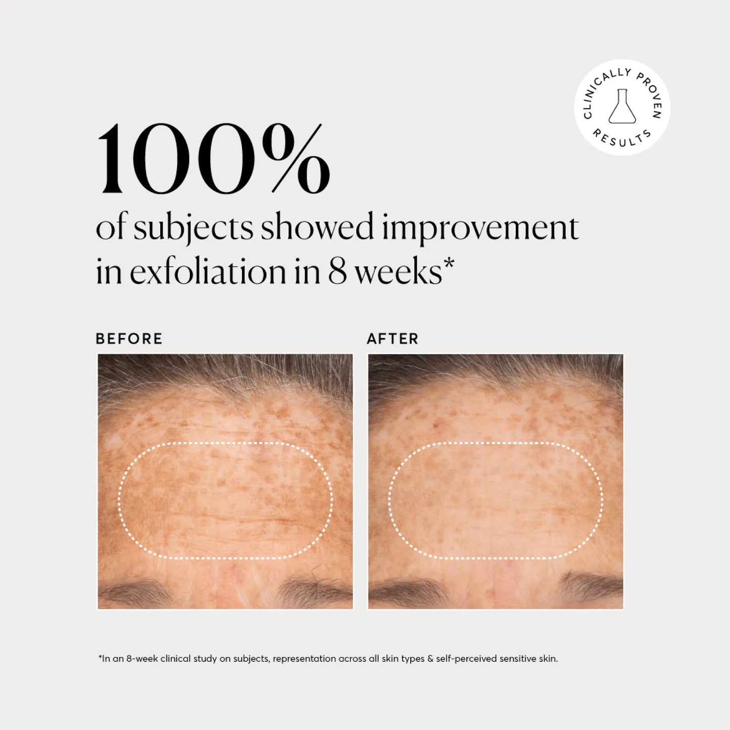 bha-liquid-exfoliant-2-j8 NATR-10027-Alt-Images-BHA-Liquid-Exfoliant-2_-03.webp